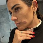 Agresión a alcaldesa de la Cuauhtémoc en la Zona Rosa